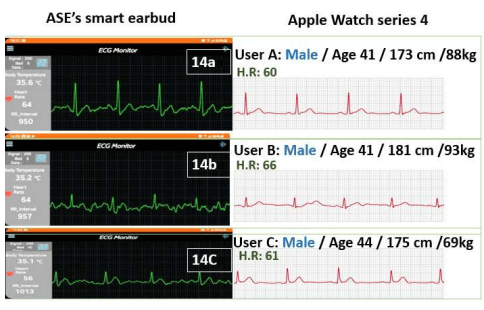 Fig. 3: Electrocardiogram results using the prototype earbud correlate with the Apple watch benchmark. Source: ASE 
