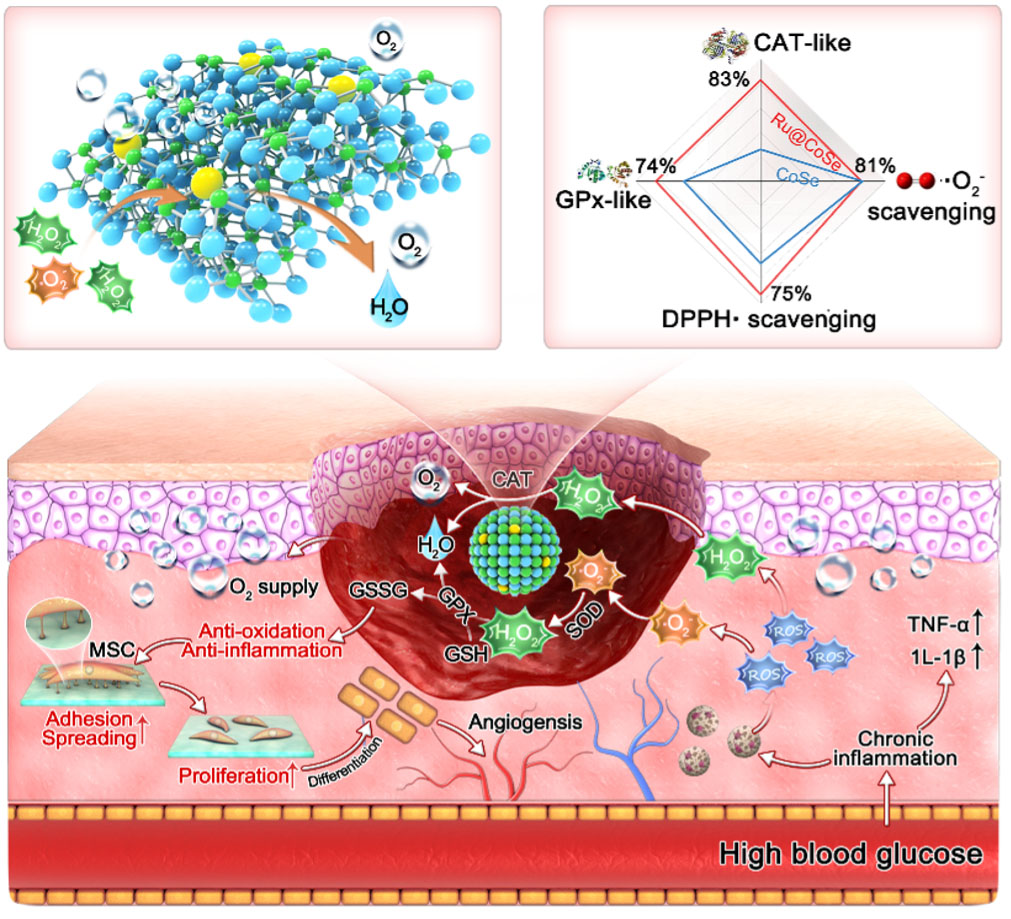 Accelerating diabetic wound healing with innovative metal selenide ROS biocatalysts