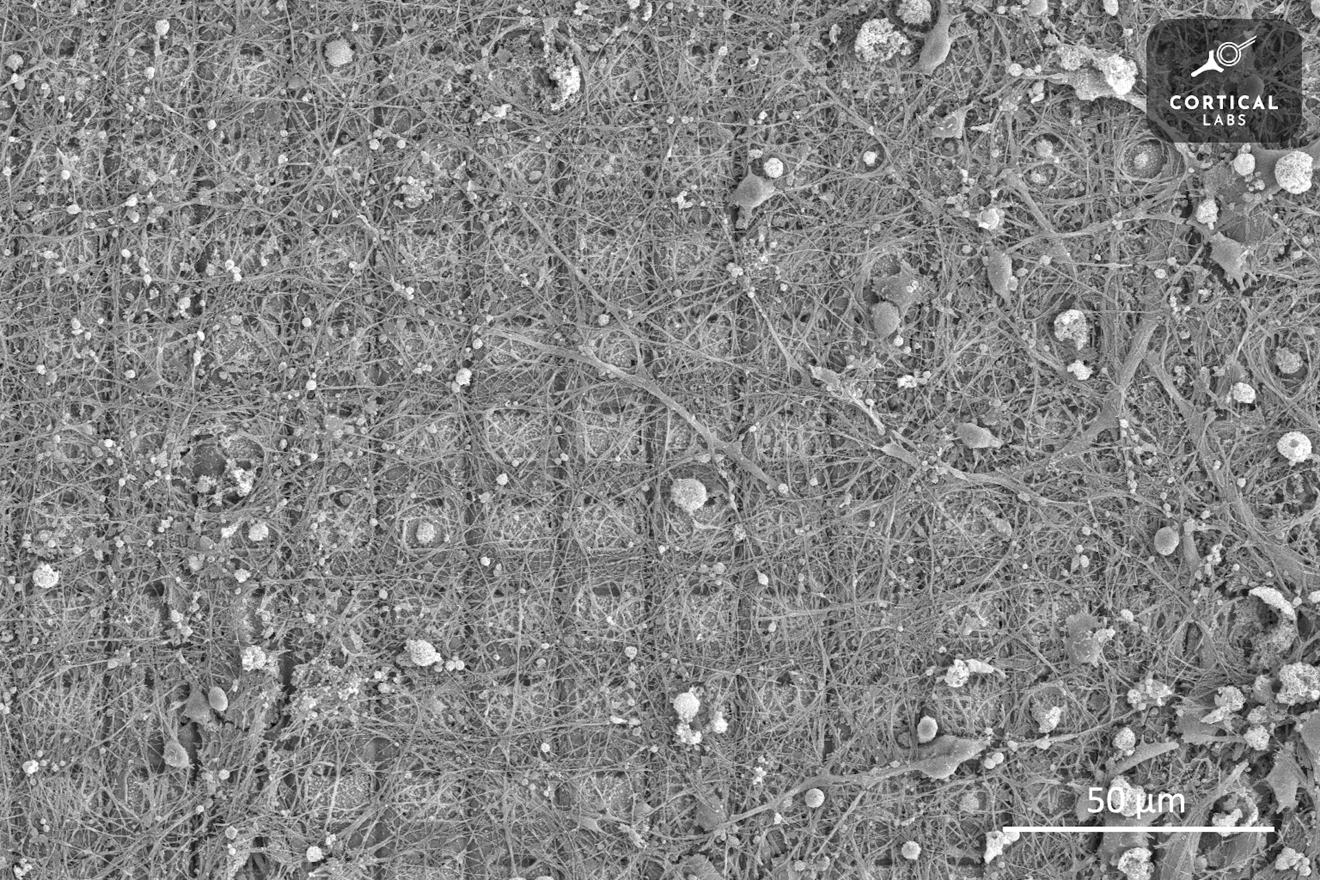 A microscope image shows a grid of squares covered with an irregular growth of strand-like neurons.